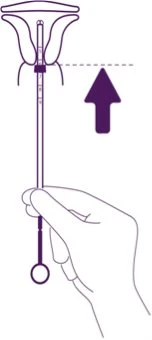 Schematic illustration of a hand inserting a thin medical device into the