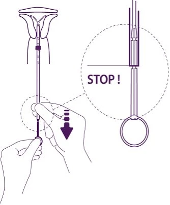 Medical diagram showing two hands holding a thin device with a ring at the base and an enlargement with the word STOP