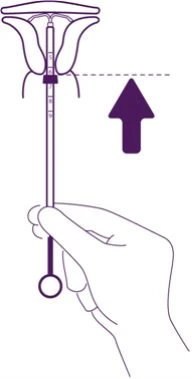 Medical diagram showing a hand holding a device for the