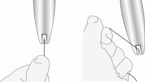 Technical drawing showing two hands handling a medical device with a thin black wire stretched between the tips of the two instruments