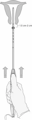 Medical diagram showing a hand holding a pen-like device with arrows pointing toward the