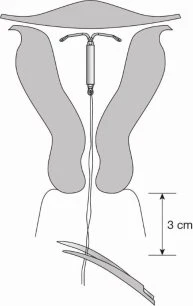 Medical diagram showing the