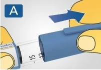 Due mani che inseriscono un cappuccio blu su un dispositivo medico trasparente con indicazioni numeriche 12 e 15 e una freccia blu direzionale