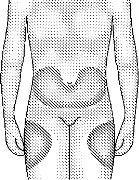 Disegno schematico di un corpo umano che evidenzia con aree ombreggiate la distribuzione del farmaco