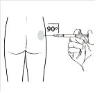 Disegno tecnico di una mano che impugna una siringa per iniettare un farmaco nel gluteo con un angolo di 90 gradi