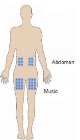 Diagram of a human body with rectangular blue areas indicating injection sites on the
