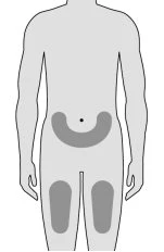 Human body diagram showing gray areas on the abdominal region and both thighs indicating drug injection sites