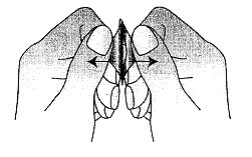 Black and white schematic drawing showing two hands spreading the edges of a skin tissue with horizontal black arrows pointing outward
