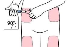 Disegno di un torso con quattro aree rosa indicate per l'iniezione