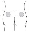 Schematic diagram of a human torso with two gray circles positioned on the hips between two horizontal dashed lines