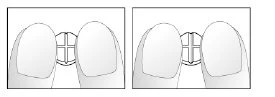 Two fingers firmly holding a small rectangular medical device with a cross engraved in the center in two adjacent panels