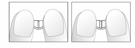 Two side-by-side diagrams show two fingers pressing the top of a small rectangular medical device with central grooves