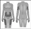 Human body diagram showing darkened areas on the abdomen, thighs, and arms indicating drug injection sites on front and back of the body