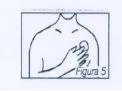 Schematic drawing of a person's torso with a hand placed on the chest over the heart to indicate the application area or site of pain