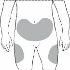Human body diagram showing gray areas on