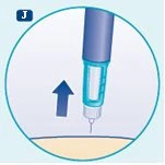 Medical illustration with a blue arrow pointing toward the