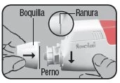 Diagramma medico che mostra l'inserimento del dispositivo
