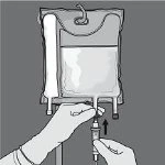 Mani guantate che regolano la valvola di un sacca per infusione contenente liquido tramite un tubo di drenaggio con una freccia nera verso il basso
