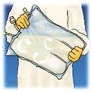 A person wearing yellow gloves holding a transparent infusion bag with white arrows indicating the rotational movement of the liquid