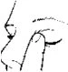 Black and white drawing showing a finger gently pressing down the lower eyelid of a closed eye to apply medication