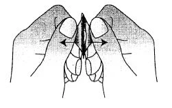 Schematic drawing of two hands squeezing and opening a medical device with black arrows indicating lateral movement