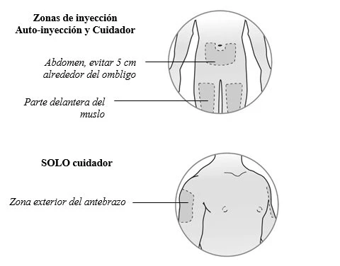 Diagramma medico con tre zone di iniezione: addome lontano dall'ombelico, coscia e braccio