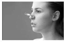 Profile of a young woman with a transparent medical device inserted into her nostrils for nasal drug delivery