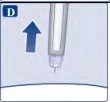 Medical diagram with a blue arrow pointing downward