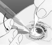 Disegno medico che mostra mani che utilizzano un bisturi e una pinzetta per eseguire un intervento chirurgico sull'