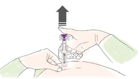 Two hands holding a medical device with a needle being removed vertically from the abdominal skin upward toward the