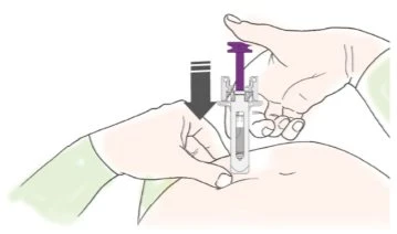 Two hands holding a transparent medical device against the skin of the