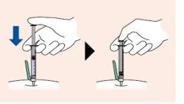 Illustrazione di due mani che impugnano una siringa per un'iniezione sottocutanea con una freccia blu verso il basso e un triangolo nero