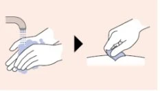 Disegno che mostra due mani che si lavano sotto l'acqua corrente seguite da una mano che applica un tampone su una superficie cutanea