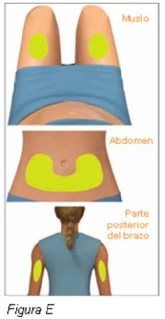 Medical diagram with three illustrations of human bodies showing yellow areas indicating injection sites