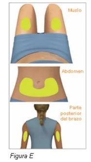 Medical diagram with three illustrations showing yellow areas for injection sites