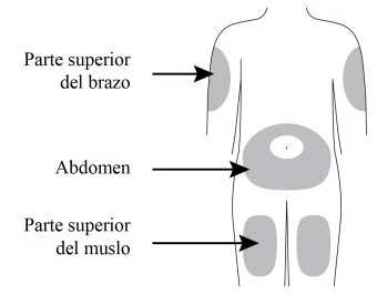 Diagramma del corpo umano con frecce che indicano le zone di iniezione sulla parte superiore del braccio, sull'anca e sulla coscia