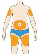 Human body diagram with orange zones indicating injection sites on arms, on