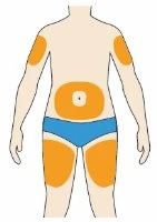 Diagram of a human body with orange areas indicating injection sites on arms, abdomen, and thighs above a pair of blue underwear