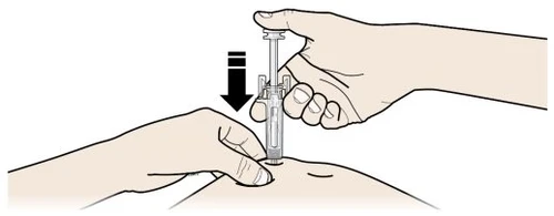 Two hands hold a transparent syringe to apply it to the skin with a downward movement indicated by a black arrow