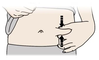 Drawing of a torso with hands pinching the skin of the