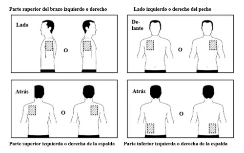Diagramma medico con quattro riquadri che mostrano figure umane stilizzate per indicare i siti di iniezione su braccio, petto e schiena