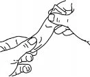 Line drawing showing two hands stretching and pulling the skin of an arm to prepare the area for