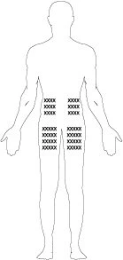 Silhouette stilizzata di un corpo umano con gruppi di piccole croci nere disposte simmetricamente su di esso