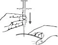 A hand holding a syringe and pushing it vertically downward to insert it