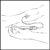A hand holding a medical device connected via a thin tube to a catheter inserted into a patient's arm