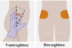 Medical diagram showing two intramuscular injection sites on the buttock, labeled as ventrogluteal with one hand and dorsogluteal with two orange areas