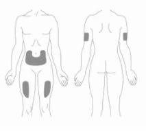 Disegni schematici del corpo umano che mostrano le zone di applicazione del farmaco sull'addome, sulle cosce e sulla parte superiore delle braccia