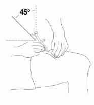 Disegno tecnico che mostra una mano che inserisce una siringa con un angolo di 45 gradi nella parte superiore della coscia di una persona