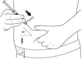 Disegno tecnico che mostra una mano che inserisce un ago in una siringa nell'addome con un angolo di 45 gradi indicato da una freccia e un arco