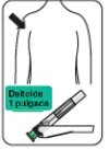 Disegno schematico di un busto umano con freccia che indica il muscolo deltoide e dispositivo medico in basso con scritta Deltoide 1 pulgada